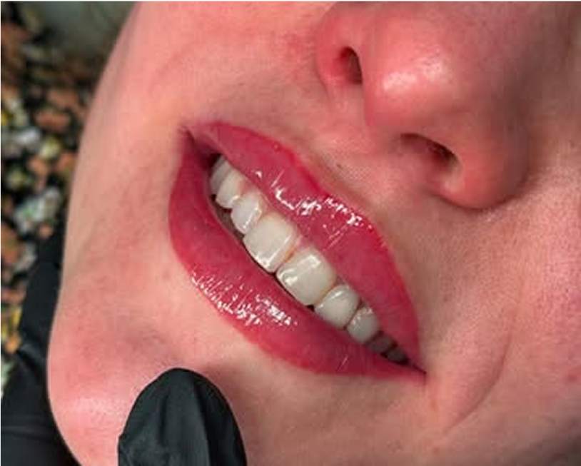 Permanente make up behandeling lipblush